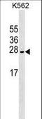Leucine Zipper And CTNNBIP1 Domain Containing antibody, LS-C158089, Lifespan Biosciences, Western Blot image 
