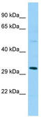 SplA/Ryanodine Receptor Domain And SOCS Box Containing 1 antibody, TA331360, Origene, Western Blot image 