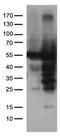 Catalase antibody, TA502497, Origene, Western Blot image 