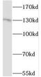 Serine/threonine-protein kinase 10 antibody, FNab08324, FineTest, Western Blot image 