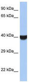 Transmembrane P24 Trafficking Protein Family Member 8 antibody, TA335116, Origene, Western Blot image 