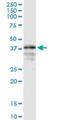 LON Peptidase N-Terminal Domain And Ring Finger 1 antibody, H00091694-M02, Novus Biologicals, Western Blot image 