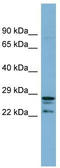 CutC Copper Transporter antibody, TA345087, Origene, Western Blot image 
