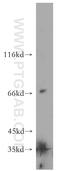 Secretogranin II antibody, 20357-1-AP, Proteintech Group, Western Blot image 