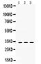 Superoxide Dismutase 3 antibody, PA5-80052, Invitrogen Antibodies, Western Blot image 