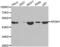 AP2M1 antibody, AHP2434, Bio-Rad (formerly AbD Serotec) , Western Blot image 
