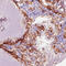 Carbonic Anhydrase 12 antibody, AMAb90639, Atlas Antibodies, Immunohistochemistry frozen image 