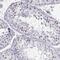 Shugoshin 1 antibody, NBP2-55825, Novus Biologicals, Immunohistochemistry paraffin image 