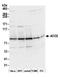 Aconitase antibody, A305-302A, Bethyl Labs, Western Blot image 