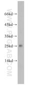 Protein Phosphatase 1 Regulatory Inhibitor Subunit 11 antibody, 20263-1-AP, Proteintech Group, Western Blot image 