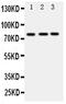 DEAD-Box Helicase 4 antibody, PA5-79147, Invitrogen Antibodies, Western Blot image 