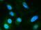 DIO1 antibody, A04612, Boster Biological Technology, Immunofluorescence image 
