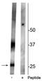 Aquaporin 2 antibody, P00935, Boster Biological Technology, Western Blot image 
