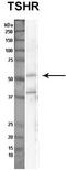 Thyroid Stimulating Hormone Receptor antibody, TA346180, Origene, Western Blot image 