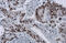 KI-67 antibody, GTX16667, GeneTex, Immunohistochemistry paraffin image 