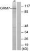 Glutamate Metabotropic Receptor 7 antibody, TA311810, Origene, Western Blot image 