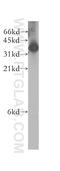 GIPC PDZ Domain Containing Family Member 2 antibody, 12832-1-AP, Proteintech Group, Western Blot image 
