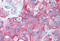 ERBB2 antibody, MBS241896, MyBioSource, Immunohistochemistry frozen image 