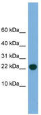 POP5 Homolog, Ribonuclease P/MRP Subunit antibody, TA345098, Origene, Western Blot image 