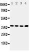 Aquaporin-7 antibody, PA5-78816, Invitrogen Antibodies, Western Blot image 