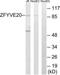 Rabenosyn, RAB Effector antibody, TA312660, Origene, Western Blot image 