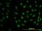 Dihydrofolate Reductase antibody, LS-C197047, Lifespan Biosciences, Immunofluorescence image 