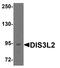 DIS3 Like 3'-5' Exoribonuclease 2 antibody, TA355005, Origene, Western Blot image 