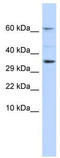 Potassium Voltage-Gated Channel Interacting Protein 2 antibody, TA338772, Origene, Western Blot image 