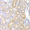 Pancreatic Lipase antibody, STJ28479, St John