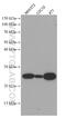 BCL2 antibody, 66799-1-Ig, Proteintech Group, Western Blot image 