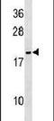 NME/NM23 Nucleoside Diphosphate Kinase 6 antibody, PA5-15346, Invitrogen Antibodies, Western Blot image 