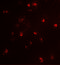 Histone-arginine methyltransferase CARM1 antibody, 7219, ProSci Inc, Immunofluorescence image 