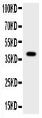 Cathepsin B antibody, PB9046, Boster Biological Technology, Western Blot image 
