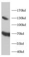 GLT-1 antibody, FNab10455, FineTest, Western Blot image 