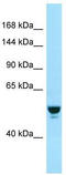 RAB GTPase Activating Protein 1 antibody, TA338104, Origene, Western Blot image 