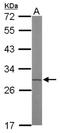 ETHE1 Persulfide Dioxygenase antibody, NBP2-16385, Novus Biologicals, Western Blot image 