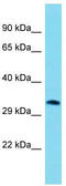 Androgen Induced 1 antibody, TA337973, Origene, Western Blot image 