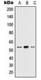 HTR2A antibody, orb214071, Biorbyt, Western Blot image 