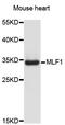 Myeloid Leukemia Factor 1 antibody, STJ24562, St John