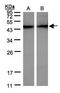 Protein Tyrosine Kinase 2 antibody, orb14844, Biorbyt, Western Blot image 