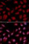 CD3 antibody, orb135199, Biorbyt, Immunofluorescence image 