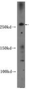Centrosomal protein of 290 kDa antibody, FNab01602, FineTest, Western Blot image 