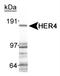Erb-B2 Receptor Tyrosine Kinase 4 antibody, NB100-2662, Novus Biologicals, Western Blot image 