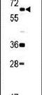 DEAD-Box Helicase 5 antibody, PA5-14366, Invitrogen Antibodies, Western Blot image 