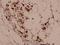 Parkin RBR E3 Ubiquitin Protein Ligase antibody, A31800T125, Boster Biological Technology, Immunohistochemistry frozen image 