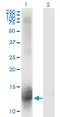 Nuclear Receptor Subfamily 3 Group C Member 2 antibody, LS-C197690, Lifespan Biosciences, Western Blot image 