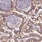 ArfGAP With Coiled-Coil, Ankyrin Repeat And PH Domains 3 antibody, NBP2-14257, Novus Biologicals, Immunohistochemistry frozen image 
