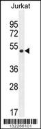 Smad Nuclear Interacting Protein 1 antibody, 56-302, ProSci, Western Blot image 