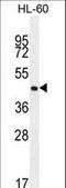 Olfactory Receptor Family 2 Subfamily F Member 2 antibody, LS-C163164, Lifespan Biosciences, Western Blot image 