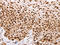 Poly(ADP-Ribose) Polymerase 1 antibody, CSB-PA436053, Cusabio, Immunohistochemistry paraffin image 
